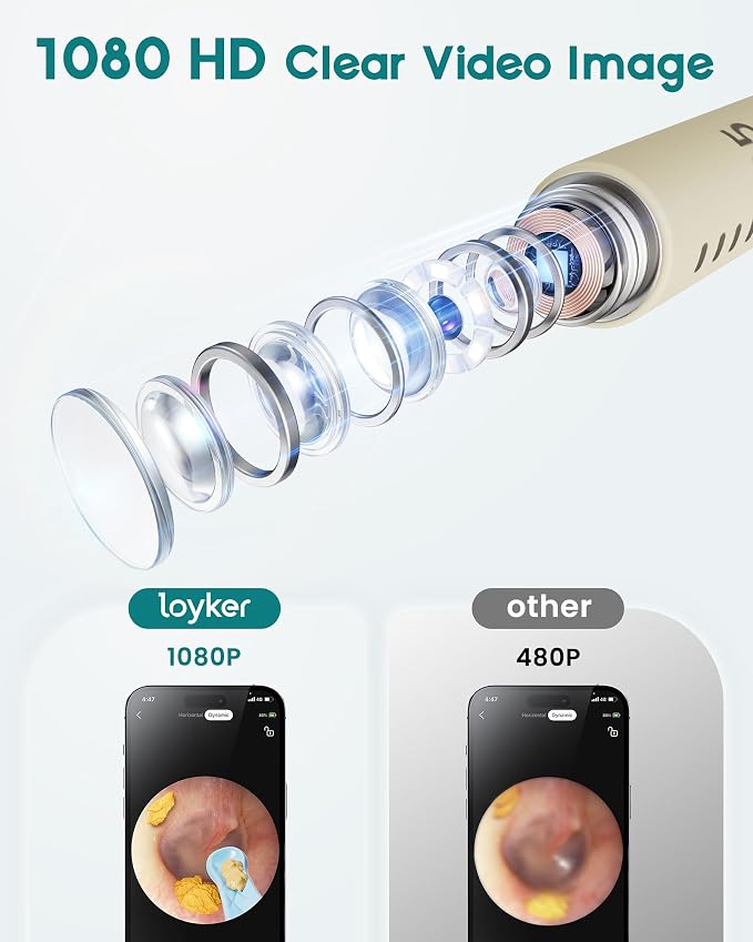 Loyker Ear Wax Removal, Ear Cleaner with 1080P Camera, Ear Cleaning Kit with 12 Ear Pick, Visual Ear Picker Earwax Remover Tweezers with 6LED Light, Ear Camera for iPhone, iPad, Android Phones, White