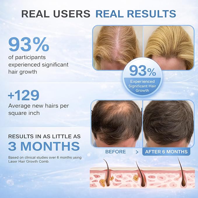 Obiredk ㅤLaser Hair Growth Comb, 650nm Red Light Therapy for Hair Regrowth, FDA Cleared LLLT Scalp Massager for Thinning Hair & Receding Hairline Rechargeable - Black
