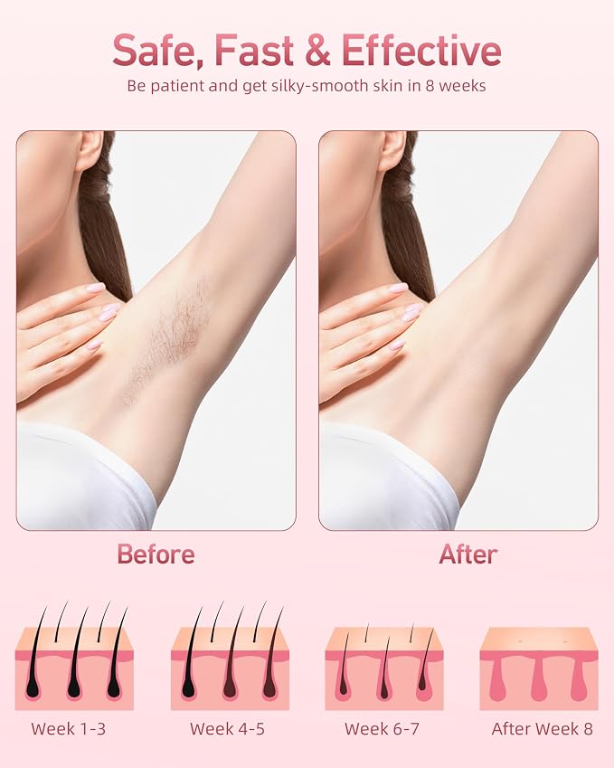 IPL Laser Permanent Hair Removal Device with Protective Goggles, 86% Hair Reduction in 3 Weeks & 5 Custom Energy Levels, Perfect for Men & Women's At-Home Full Body and Face, White