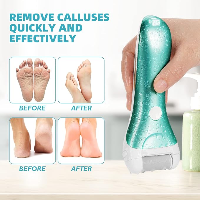 Callus Remover for Feet, Nicebirdie Electric Foot File Callus Removers Rechargeable Waterproof Pedicure Tools Foot Scrubber Shaver Feet Care Tool for Cracked Heels Dead Skin （Blue+Golden ）