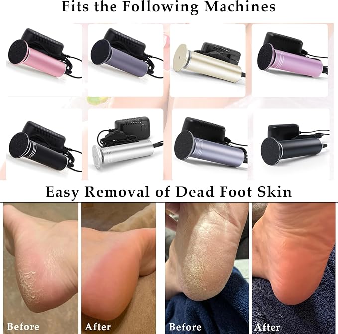 120pcs Foot File Sandpaper Discs Refill for Electric Callus Remover Dead Skin Removal (60pcs Rough 80 Grit + 60pcs Smooth 180 Grit)