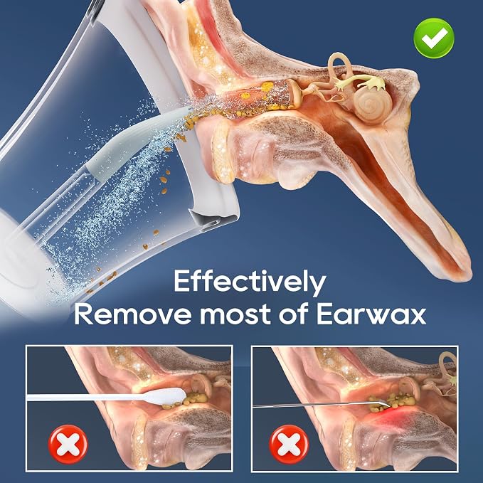 Ear Wax Removal, Electric Ear Cleaning Kit Effective & Safe Ear Cleaner Irrigation Flushing System 4 Pressure Modes for Ear Wax Buildup, Water Resistant Ear Cleaning Tool USB Rechargeable