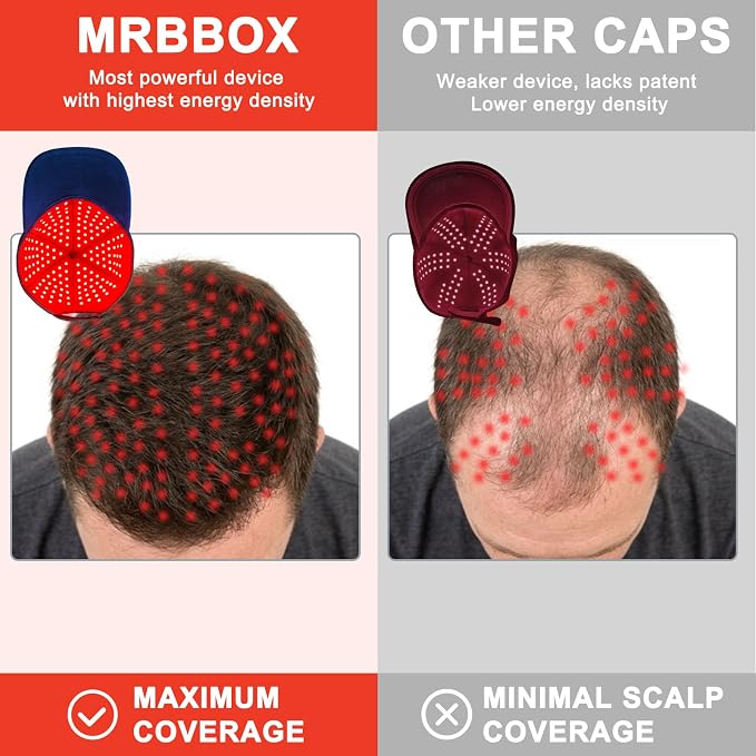 Red Light Therapy for Hair Growth,528 Total Light Emitters,Full-Scalp Coverage,660nm Red Light + NIR, At-Home Scalp Care,Red Light Hair Growth Cap (LP-RJVGRW-BLK)