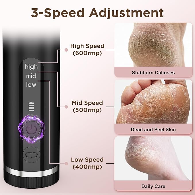 Electric Foot Callus Remover with Nano-Glass Head & 60Pcs Sandpaper Discs, 4 Hours Run Time, Electric Callus Remover for Feet with 3 Adjustable Speeds, Pedicure Tools for Dry Dead Skin Cracked Heels