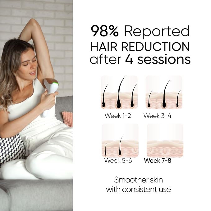 Sensica Sensilight PRO IPL Hair Removal Device, At-Home Cordless Use, XL Body Window for Fast Full-Body Use & Precision Window for Face, Auto Glide, 2 Smart Sensors, 6 Energy Levels - IPL300