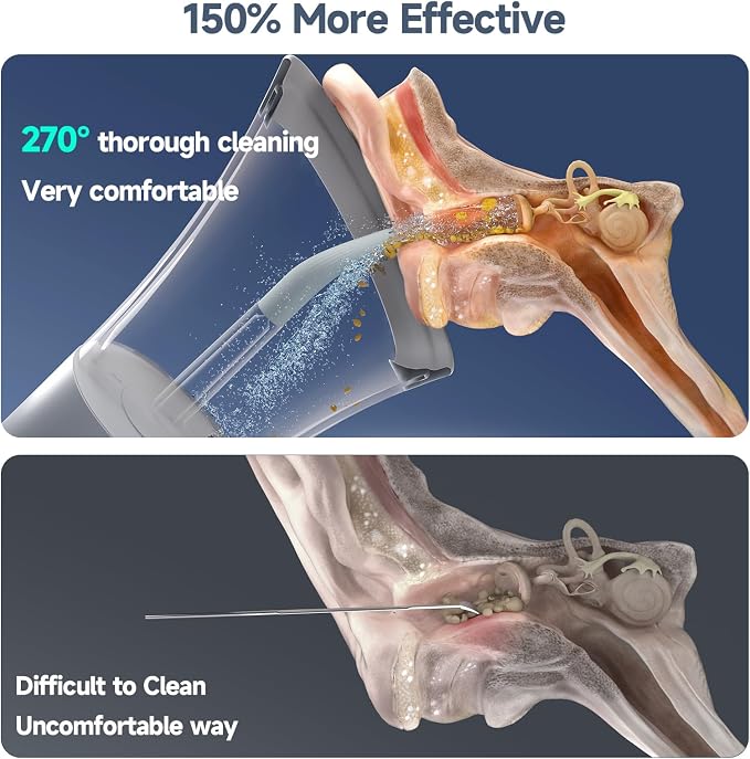 Ear Wax Removal, Electric Ear Cleaning Kit Effective & Safe Ear Cleaner Irrigation Flushing System 4 Pressure Modes for Ear Wax Buildup, Water Resistant Ear Cleaning Tool USB Rechargeable