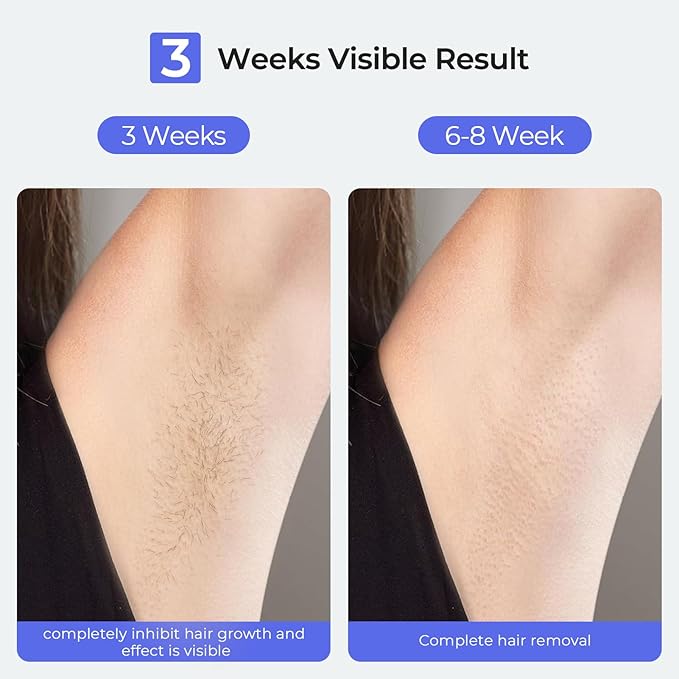 Laser Hair Removal, IPL Laser Hair Removal Device for Women & Men, Home 41°FSapphire Ice-Cooling, Nearly Painless, Safe and Long-Lasting Hair Removal for Full Body & Face, 999,999+flashes