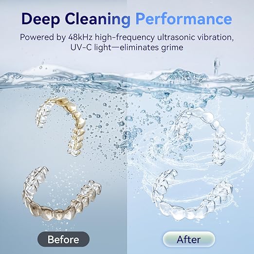 Ultrasonic Retainer Cleaner Machine 48kHz, Dental Cleaning Pod, Ultrasonic Retainer Cleaner for Dentures, Aligners, Mouth Guards, Toothbrush Heads and Jewelry with 200ML Capacity, LAB Supply | Gentle cleaning action works well on mouth guards, toothbru...