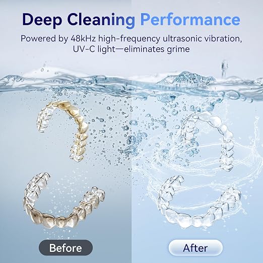 Ultrasonic Retainer Cleaner Machine 48kHz, Dental Cleaning Pod, Ultrasonic Retainer Cleaner for Dentures, Aligners, Mouth Guards, Toothbrush Heads and Jewelry with 200ML Capacity, LAB Supply | Gentle cleaning action works well on mouth guards, toothbru...
