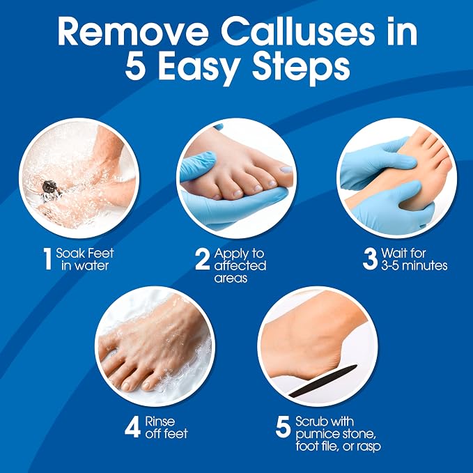 DeEnti Callus Remover for Feet, Extra Strength Foot Callus Remover Gel, 128oz Gallon Salon Grade Bulk Pedicure Supplies for Dry Skin, Cracked Heel, Professional Strength Foot Care, Unscented