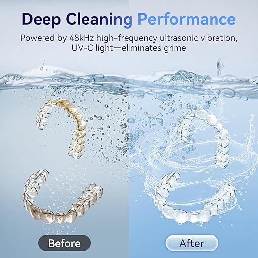 Ultrasonic Retainer Cleaner Machine 48kHz, Dental Cleaning Pod, Ultrasonic Retainer Cleaner for Dentures, Aligners, Mouth Guards, Toothbrush Heads and Jewelry with 200ML Capacity, LAB Supply | Gentle cleaning action works well on mouth guards, toothbru...