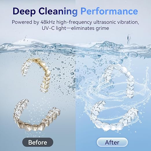 Ultrasonic Retainer Cleaner Machine 48kHz, Dental Cleaning Pod, Ultrasonic Retainer Cleaner for Dentures, Aligners, Mouth Guards, Toothbrush Heads and Jewelry with 200ML Capacity, LAB Supply | Gentle cleaning action works well on mouth guards, toothbru...