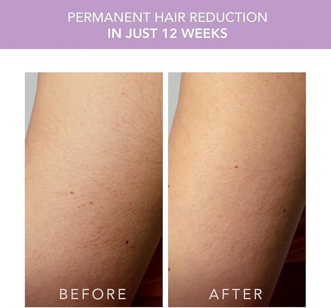 FOREO Peach 2 go IPL Hair Removal Device - Travel-Friendly Permanent Removal - Laser Treatment for Body & Face - Painless & Skin Cooling - Silicone Shield - Customizable - Lavander