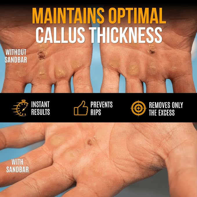 SandBar Ultimate Callus Remover Set - 4" & 8" Files with Moisturizing Salve Balm Stick - Elevating Athletes, Weightlifters & Rock Climbers for Smoother Hands & Feet - Gold (Black) (Gold Bundle)