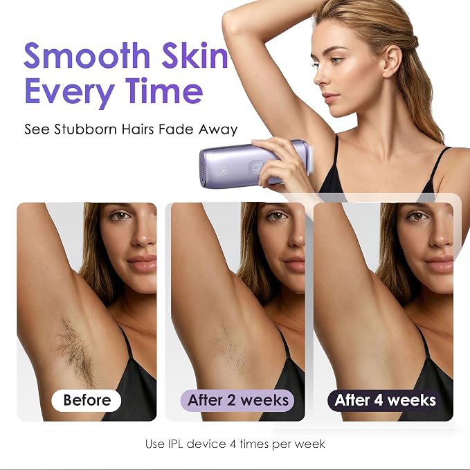 IPL Laser Hair Removal Device for Women & Men, 25J Sapphire Ice Cooling for Nearly Painless Hair Removal, Visible Hair Reduction in 2 Weeks, Skin Sensor & Auto Flash for Full Body,Purple