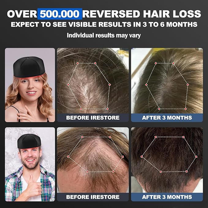 Laser Cap, FDA Cleared Red Light Therapy for Hair Growth | Laser Hair Growth Cap,Wavelength 650nm,Full scalp laser coverage,promote hair growth in women and men