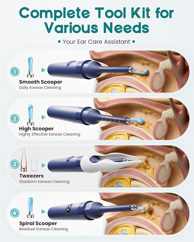 Loyker Ear Wax Removal, Ear Cleaner with 1080P Camera, Ear Cleaning Kit with 12 Ear Pick, Visual Ear Picker Earwax Remover Tweezers with 6LED Light, Ear Camera for iPhone, iPad, Android Phones, Blue
