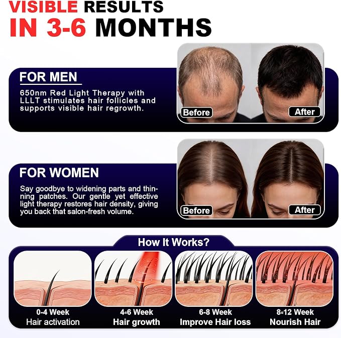 Red Light Therapy for Hair Growth Laser Cap – 650nm LLLT for Hair Loss, Thinning & Alopecia, Full Scalp Coverage, At-Home Treatment for Men & Women - Blue