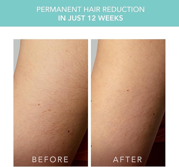 FOREO Peach 2 go IPL Hair Removal Device - Travel-Friendly Permanent Hair Removal - Laser Hair Removal - Body & Face - Painless Hair Removal - Skin Cooling & Silicone Shield - Customizable Artic Blue