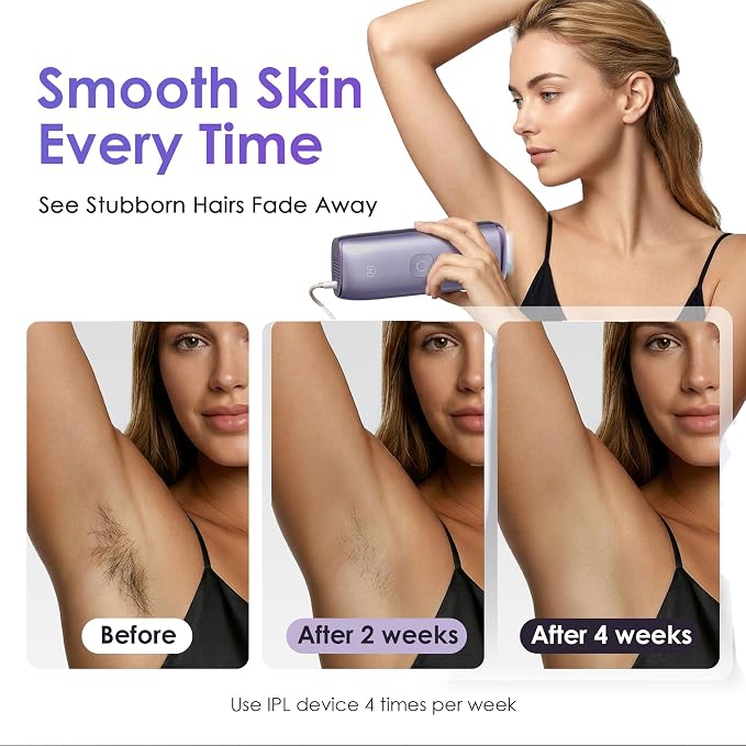 IPL Laser Hair Removal Device for Women & Men, 25J Sapphire Ice Cooling for Nearly Painless Hair Removal, Visible Hair Reduction in 2 Weeks, Skin Sensor & Auto Flash for Full Body,Violet