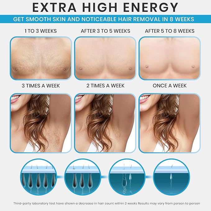Freezing Point IPL Hair Removal Device Model W-1095 – At-Home IPL Hair Remover with 5 Energy Levels and Cooling Function for Face, Arms, Legs & Bikini Area – For Women & Men