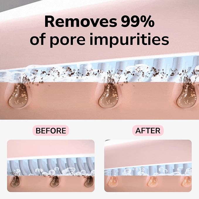 Wave Facial Sonic Cleanser | Deep Cleansing, Pore & Blackhead Care, 3 Modes, Replacable Head, 40,000 Cavitation Micro Vibrations, Waterproof Level IPX8, C-Type Charge, Korean Skincare (Gray)