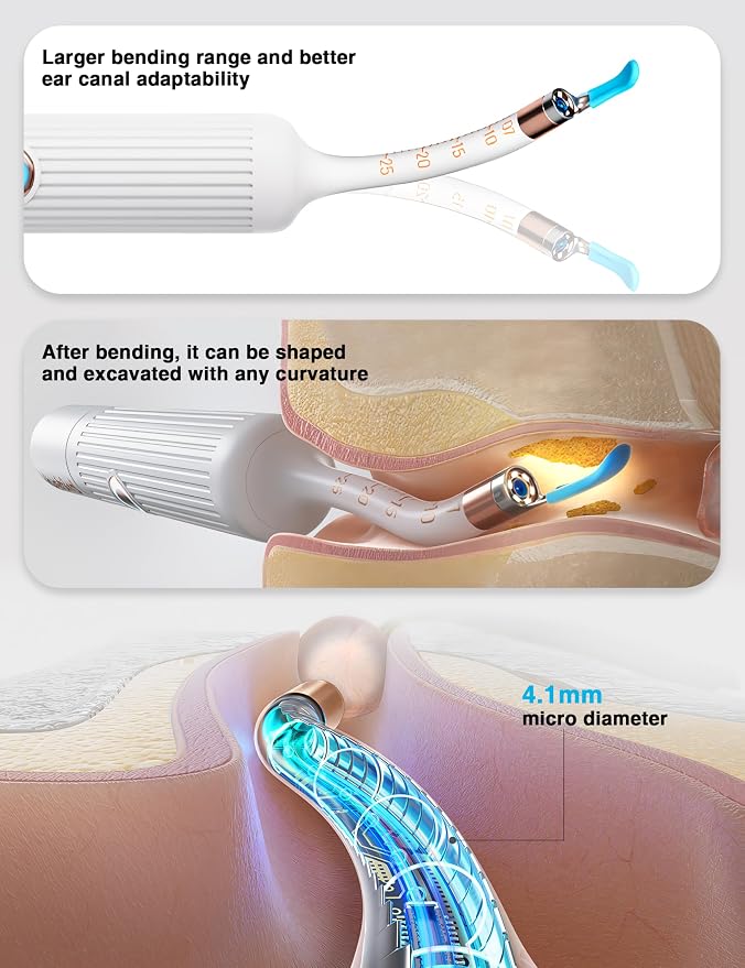 BEBIRD Earsight Plus Ear Wax Removal Tool Camera with HD Visual Otoscope, Smart WiFi Earwax Cleaner Kit, Safe Silicone Flexible Scoops & Tweezers Tools for Adults & Kids (White)