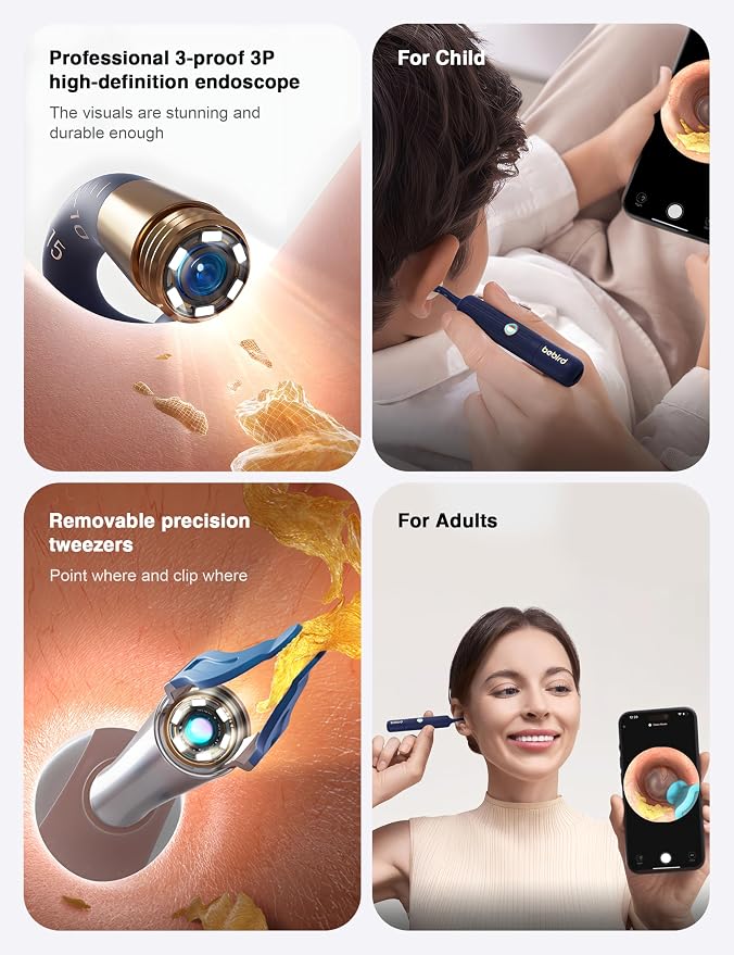 BEBIRD Earsight Plus Ear Wax Removal Tool Camera with HD Visual Otoscope, Smart WiFi Earwax Cleaner Kit, Safe Silicone Flexible Scoops & Tweezers Tools for Adults & Kids (Blue)