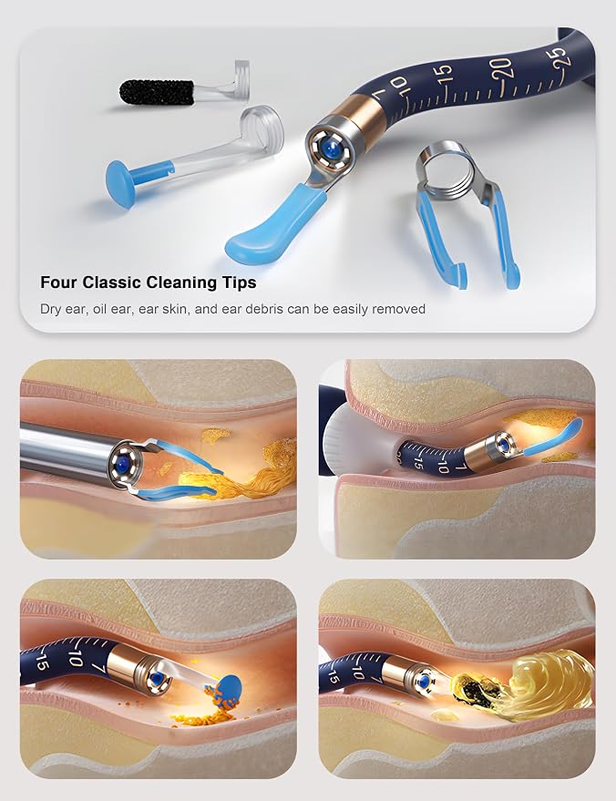 BEBIRD Earsight Plus Ear Wax Removal Tool Camera with HD Visual Otoscope, Smart WiFi Earwax Cleaner Kit, Safe Silicone Flexible Scoops & Tweezers Tools for Adults & Kids (Blue)