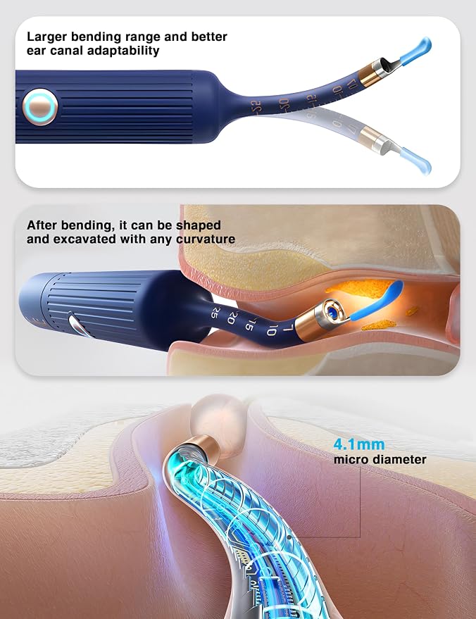 BEBIRD Earsight Plus Ear Wax Removal Tool Camera with HD Visual Otoscope, Smart WiFi Earwax Cleaner Kit, Safe Silicone Flexible Scoops & Tweezers Tools for Adults & Kids (Blue)