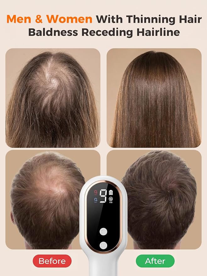 FDA-Device 650Nm LLLT Red Light Therapy For Hair Growth And Hair Loss, Cordless Handheld Scalp Laser Brush For Men & Women With Thinning Hair Baldness Receding Hairline, Portable Home Travel