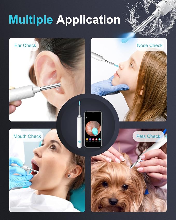 DJROLL Ear Wax Removal Endoscope, Earwax Remover Tool, Ear Camera,1080P FHD Wireless Ear Otoscope with 6 LED Lights,Ear Scope with Ear Wax Cleaner Tool for iPhone, iPad & Android Smart Phones (White)