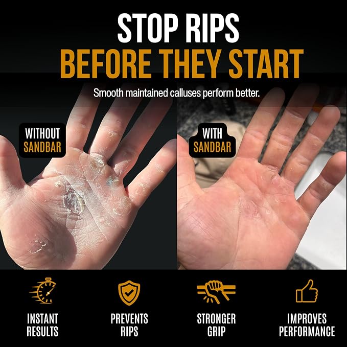 SandBar Callus Remover Tool, File for Hands, Durable Aluminum Tool Callus Shaver, Palm and Heel Dead Skin Removal, Includes Nourishing Salve, Ideal for Athletes, Climbers, and Gym Enthusiasts - Gold